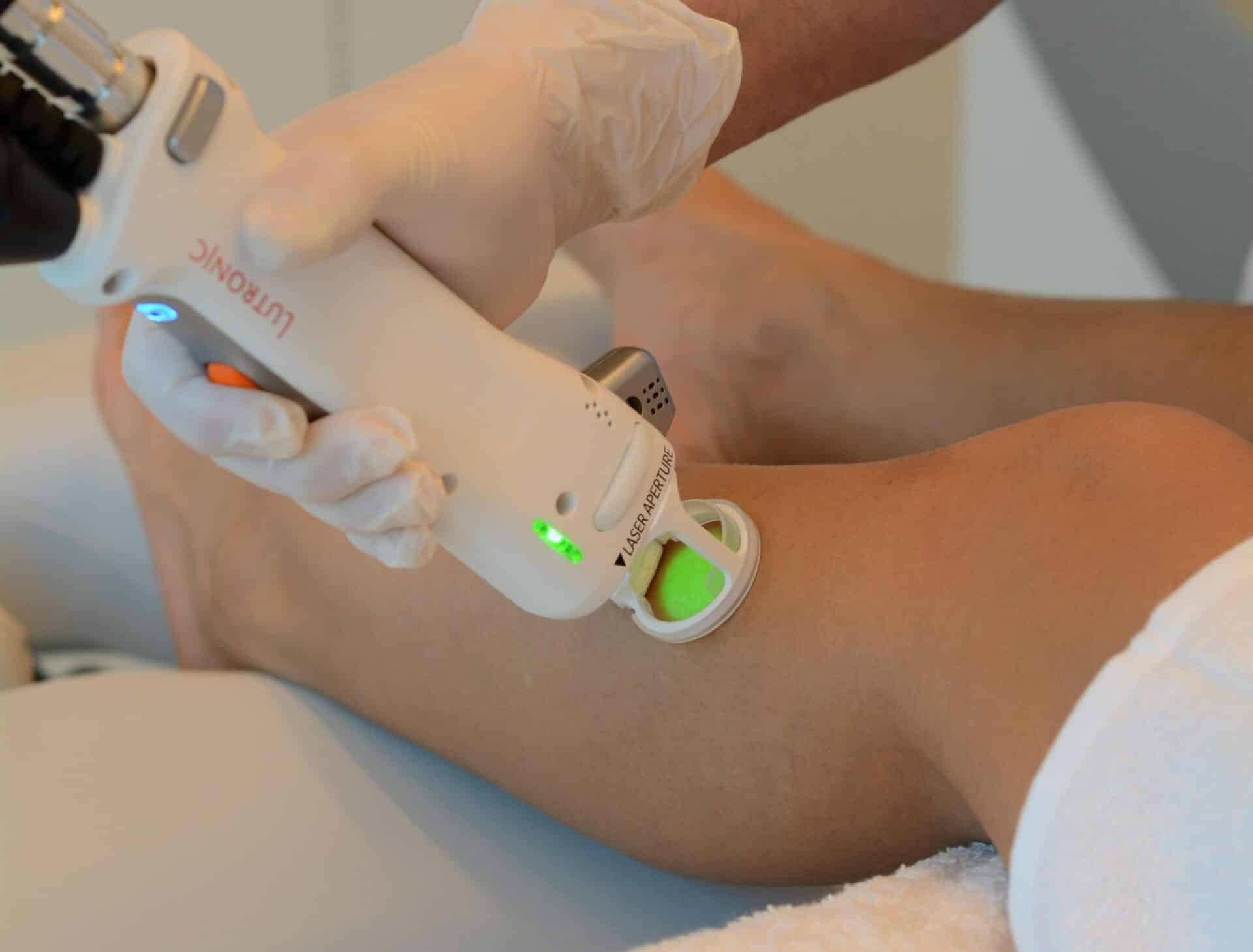 Lasertherapie Huidkliniek Maas en Waal